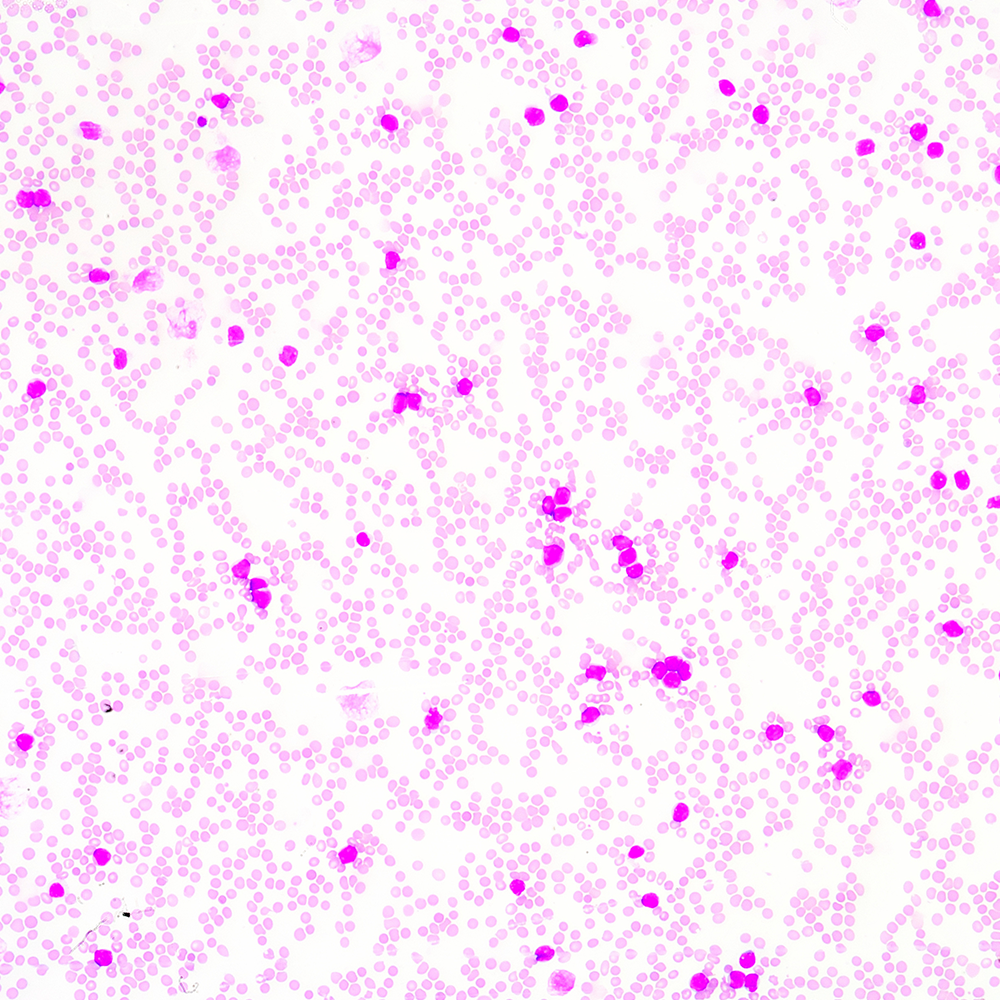 臺(tái)盼藍(lán) VS AOPI：細(xì)胞活率計(jì)數(shù)，哪種染色更合你意？